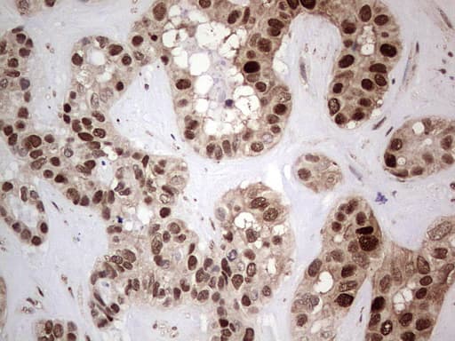 PCNA Antibody (clone OTI13G4)