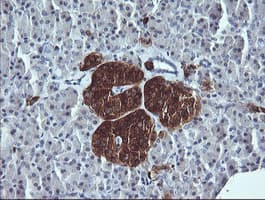 SYP / Synaptophysin Antibody (clone OTI1G3)