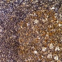 DAPK2 / DAP Kinase 2 Antibody