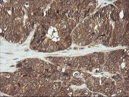 CDKN2B / p15 INK4b Antibody (clone OTI8H4, Carrier-free)