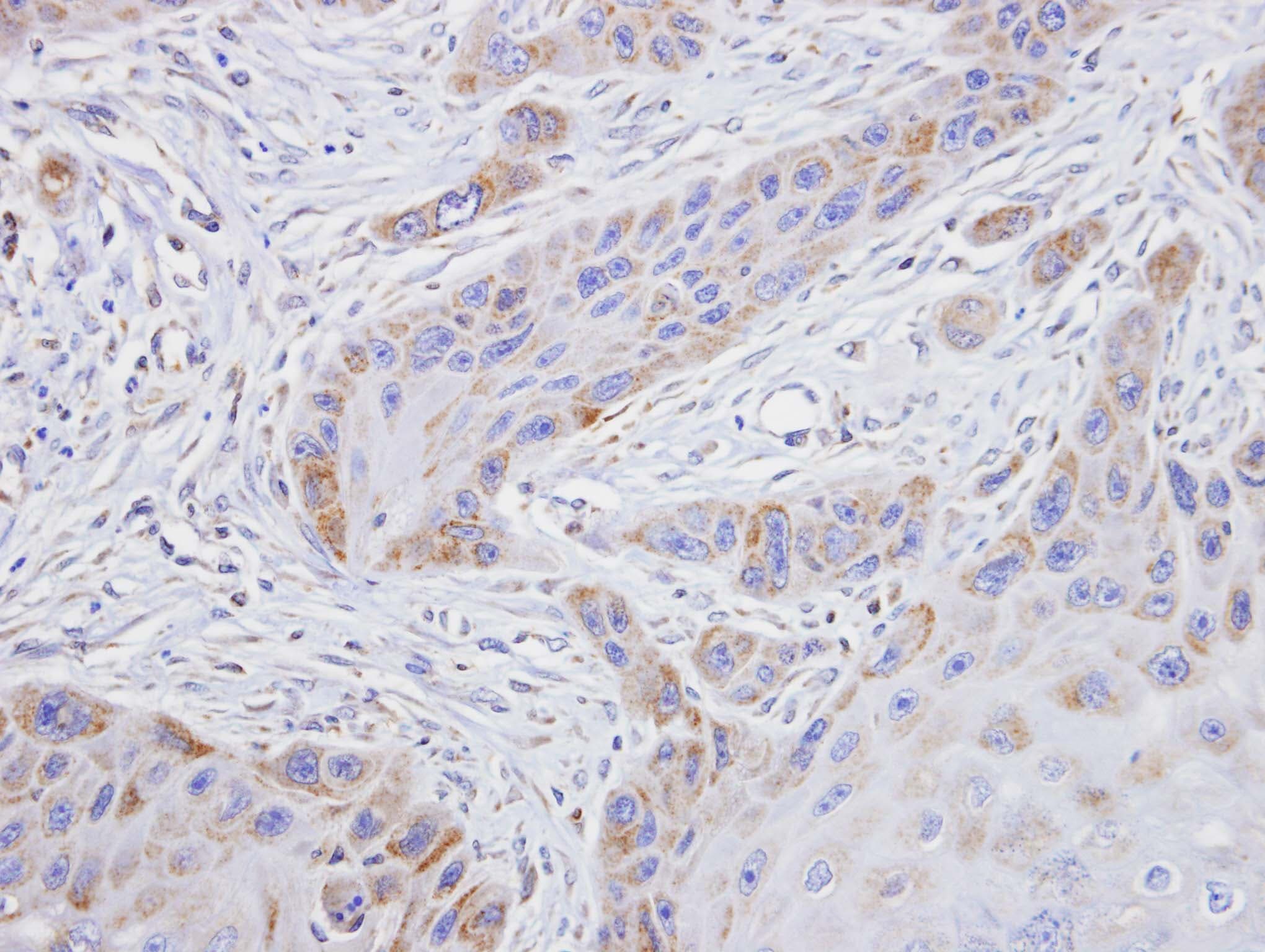 TROVE2 Antibody (aa178-459)