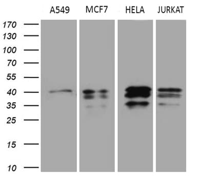 Monoclonal Mouse anti-Human UPRT Antibody (clone OTI1D12, IHC, WB)