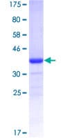 Human EWSR1 / EWS Protein (Recombinant GST, N-terminus)