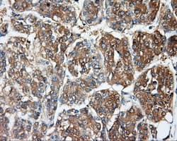 DNTTIP1 / TDIF1 Antibody (clone OTI1E2)