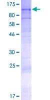 Human AGBL5 Protein (Recombinant GST)