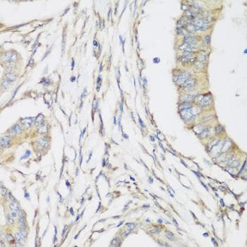 SH3GLB2 / Endophilin-B2 Antibody