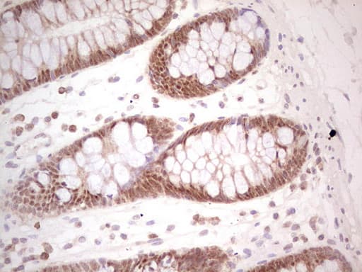 HnRNP-E1 / PCBP1 Antibody (aa1-225, clone OTI3B9, Carrier-free)