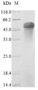 Mouse Properdin / CFP Protein (Recombinant 6His-Myc, C-terminus)