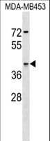 ASNA1 Antibody (aa284-312)