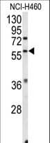 ESRRB / ERR Beta Antibody (aa275-305)