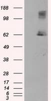 LIPG / Endothelial Lipase Antibody (clone OTI4C1, Carrier-free)