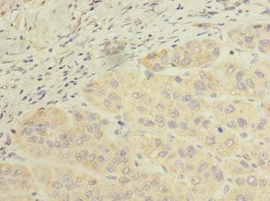 SCFD2 Antibody
