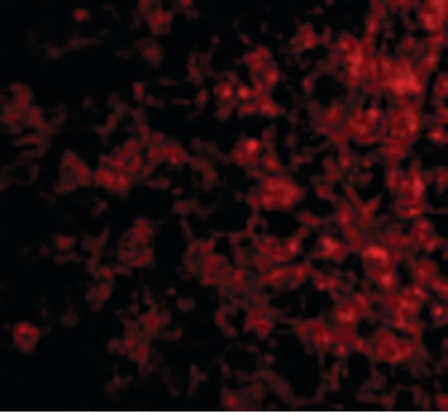 IHC-plus™ Polyclonal Rabbit anti-Human CRLF2 / TSLPR Antibody (IHC, IF, WB)