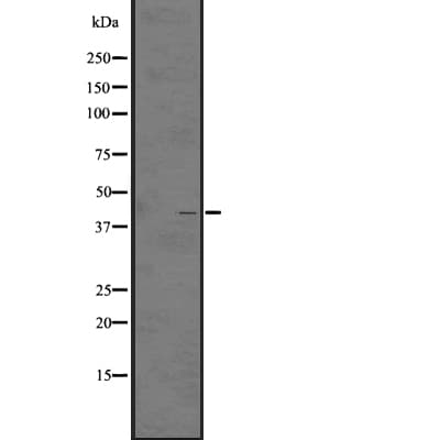 LPAR5 / GPR92 Antibody