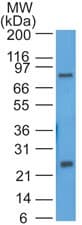 WFDC2 / HE4 Antibody (aa1-50)