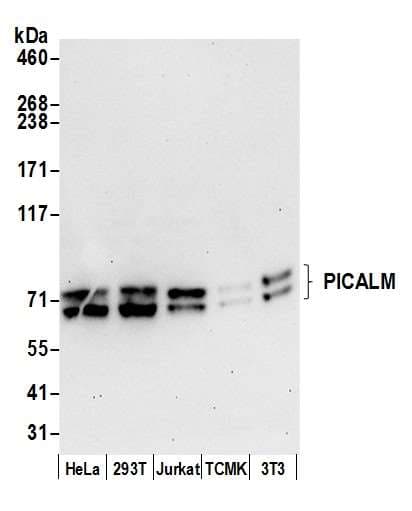 PICALM / CALM Antibody (aa602-652)