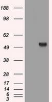 IHC-plus™ Monoclonal Mouse anti-Human SERPINA1 / Alpha 1 Antitrypsin Antibody (clone 9A1, IHC, WB)