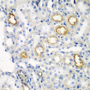 RARRES2 / Chemerin Antibody