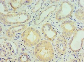 GGA2 Antibody (aa1-300)