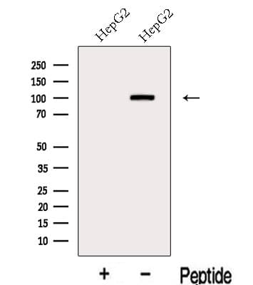 KANK2 Antibody
