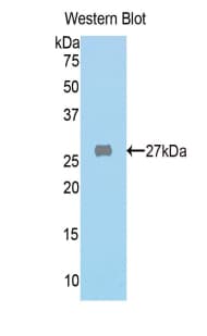 FAH Antibody (aa189-419)