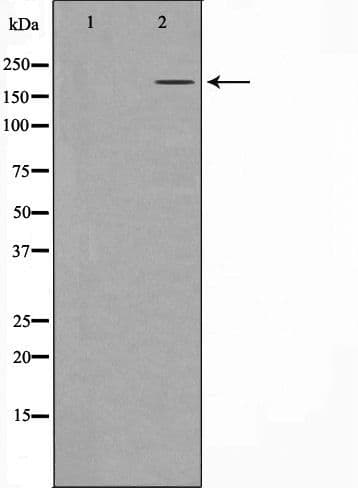 Polyclonal Rabbit anti-Human LCX / TET1 Antibody (IHC, WB)