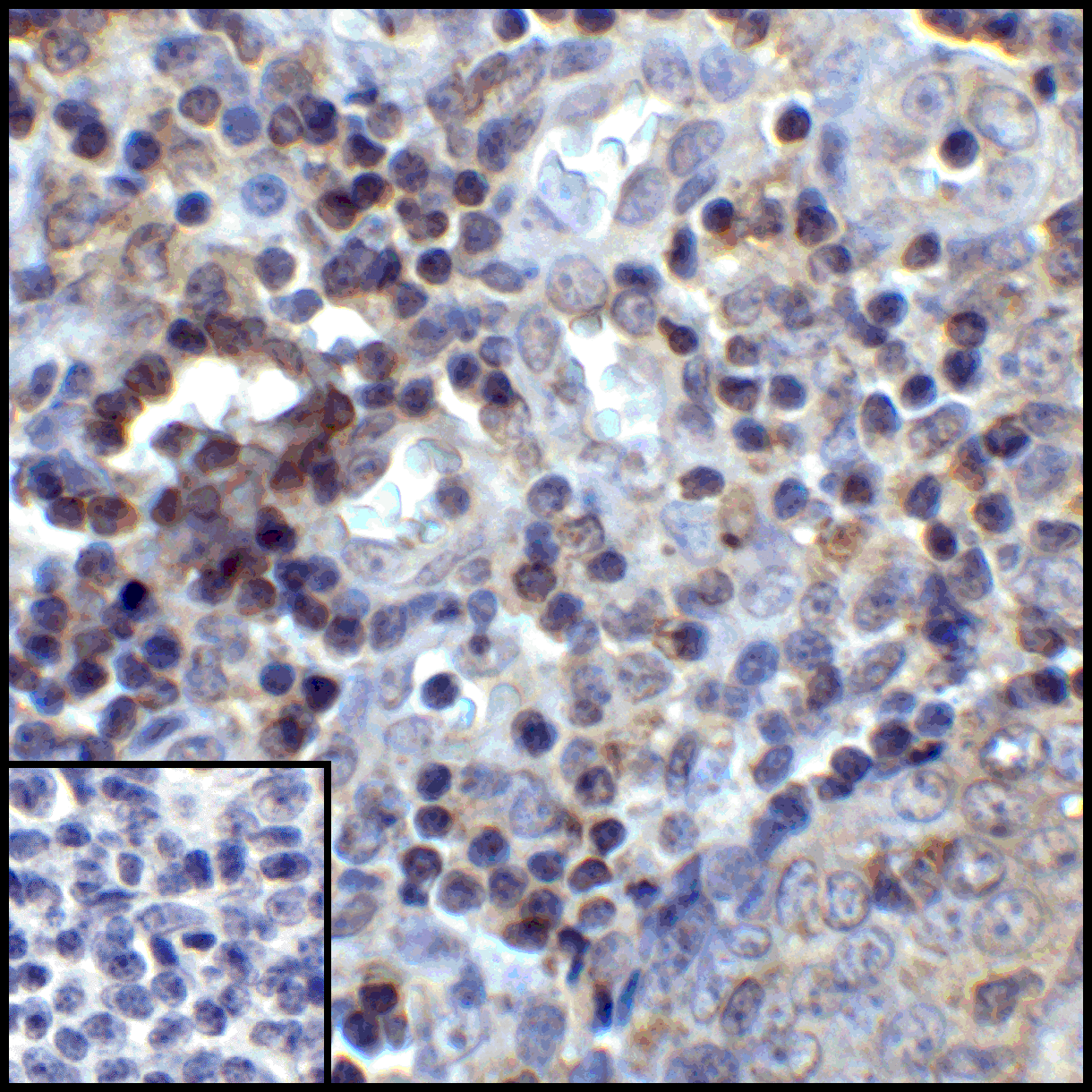 CD274 / B7-H1 / PD-L1 Antibody (clone 8E12)