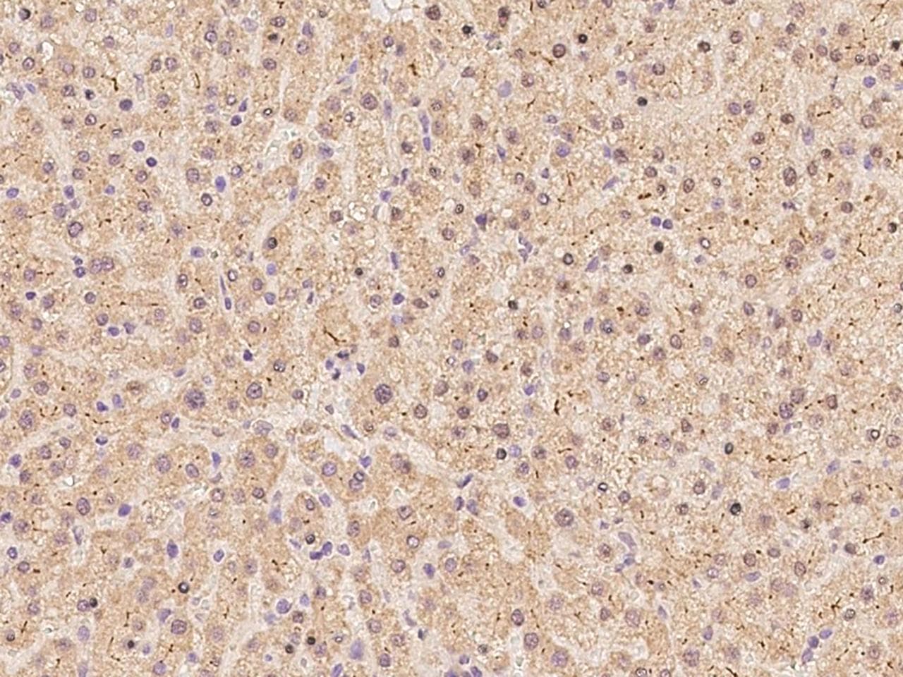 EPS8 Antibody