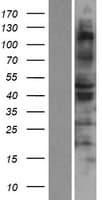 RSAD1 Protein (Over-Expression Lysate Myc-DDK (Flag))