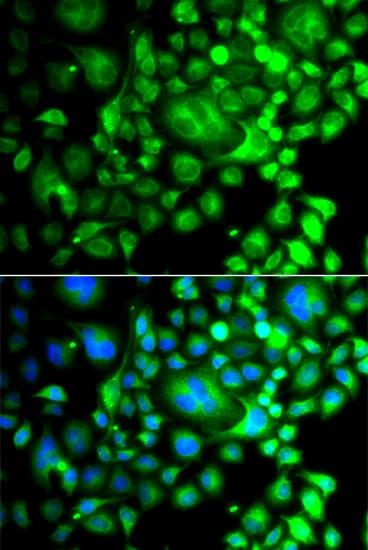Polyclonal Rabbit anti-Human SNX3 Antibody (IHC, IF, WB)