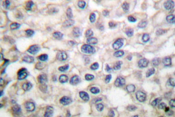 Alpha 1+2 Catenin Antibody (Pro940)