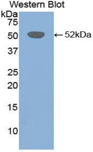 FGB / Fibrinogen Beta Chain Antibody (aa35-481, Cy3)