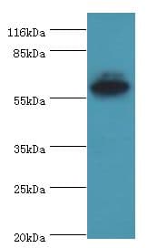 EPHX2 / Epoxide Hydrolase 2 Antibody (aa1-555)