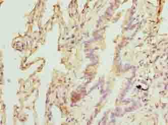 TPRKB Antibody