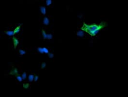 Monoclonal Mouse anti-Human MAPK3 / ERK1 Antibody (clone OTI4D7, IHC, IF, WB)