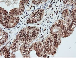 Monoclonal Mouse anti-Human MAP2K1 / MKK1 / MEK1 Antibody (clone OTI3E6, IHC, IF, WB)