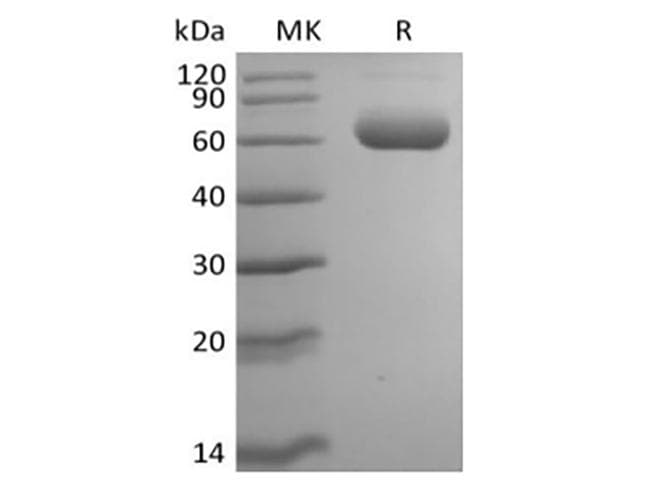 Mouse SIGLEC8 Protein (Recombinant 6His, C-terminus)