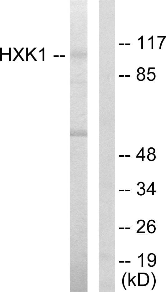 HK1 / Hexokinase 1 Antibody