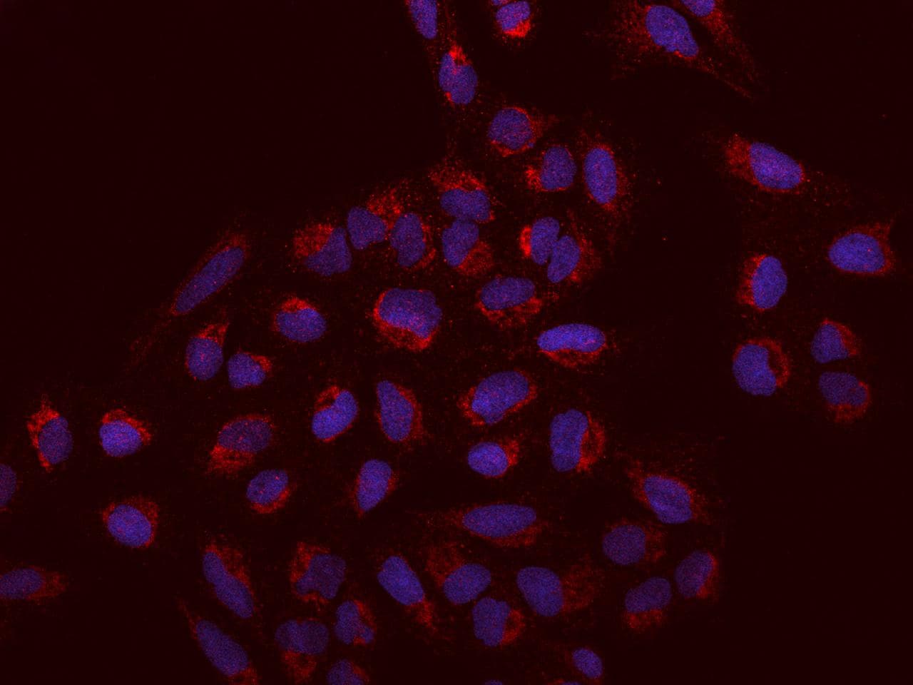 Polyclonal Rabbit anti-Human SACM1L / SAC1 Antibody (IHC, IF)