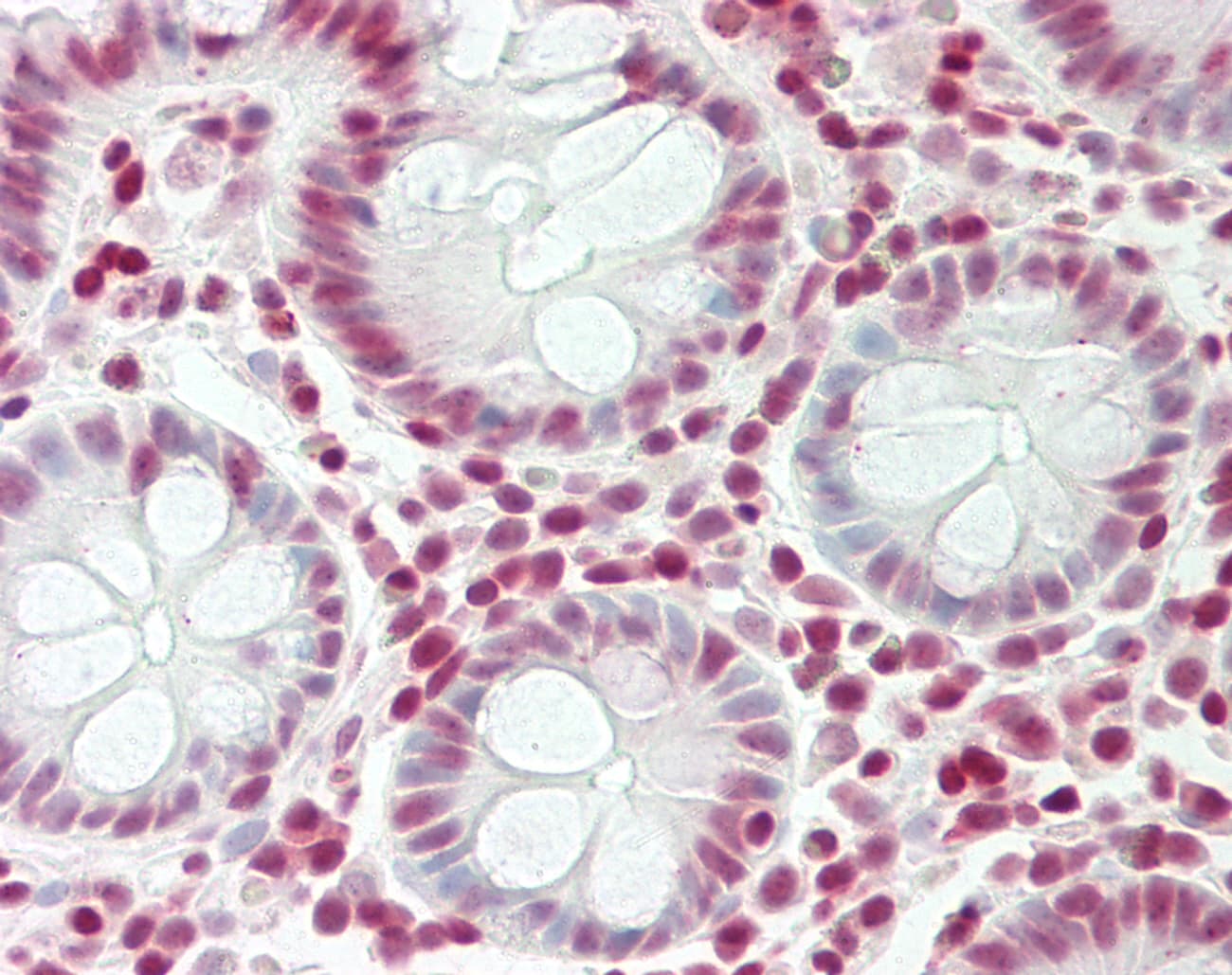 HMG1 / HMGB1 Antibody (N-Terminus)