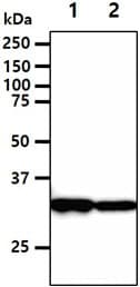 DECR1 Antibody (clone AT3B2)