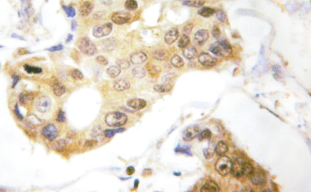 Polyclonal Rabbit anti-Human PDCD4 Antibody (phospho-Ser457, IHC, IF, WB)