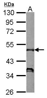NCF1 / p47phox / p47 phox Antibody