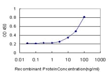 EPHX1 / Epoxide Hydrolase 1 Antibody (clone 2E7)