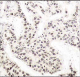Polyclonal Rabbit anti-Human ELK1 Antibody (IHC, IF)