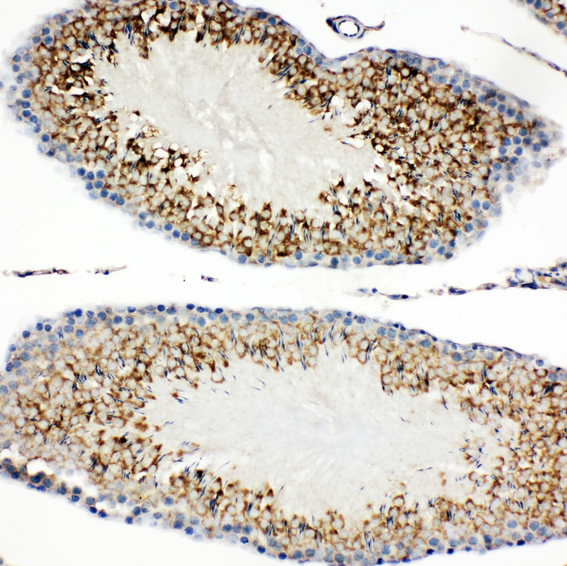 HAVCR1 / KIM-1 Antibody (aa289-307)