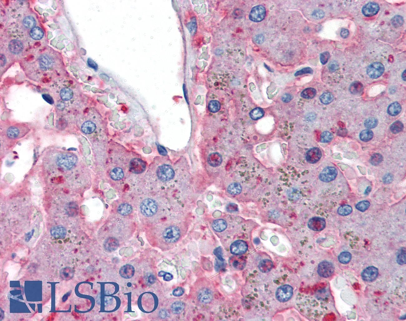 IHC-plus™ Monoclonal Mouse anti-Human FGB / Fibrinogen Beta Chain Antibody (IHC, WB)