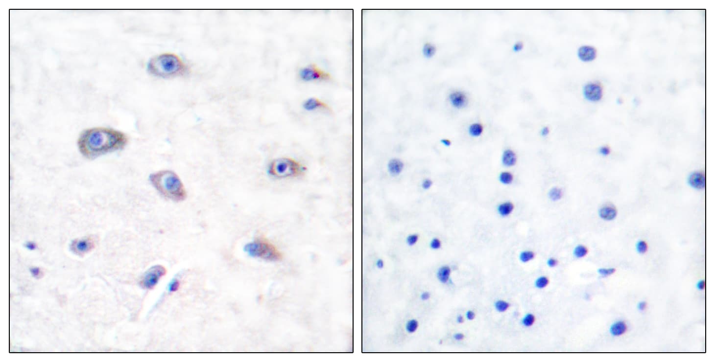 BACE1 / BACE Antibody (aa452-501)