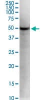 KLF5 / BTEB2 Antibody (clone 2G12)