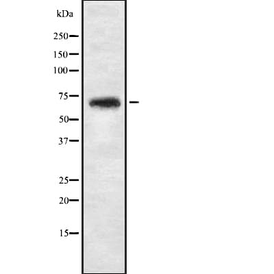 Polyclonal Rabbit anti-Human NBPF4 Antibody (IHC, WB)